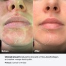 Celluma Nova