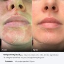 Celluma Nova